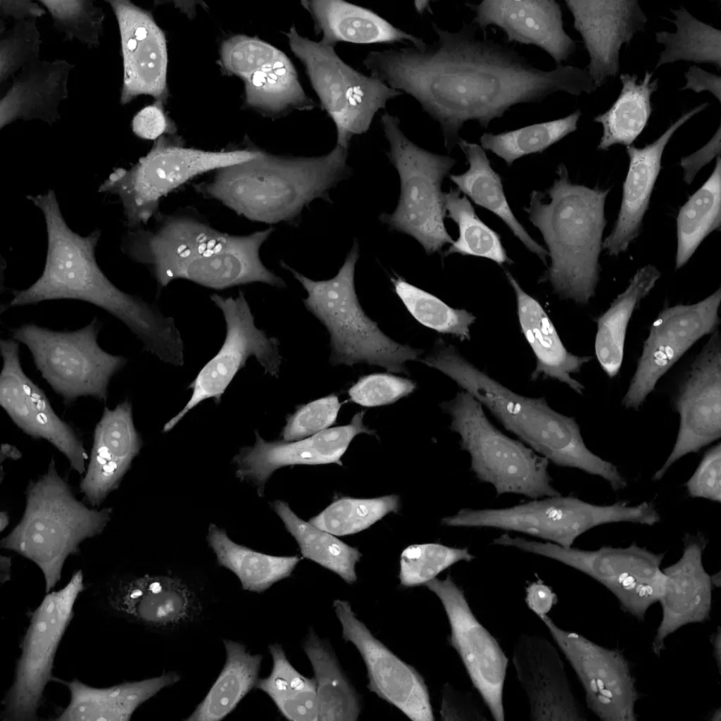 Whole-cell stain fluorescence image of the same HeLa field