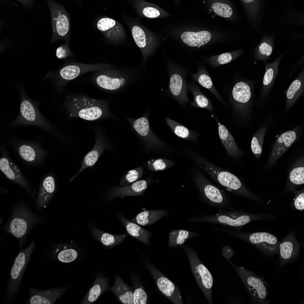 Hoechst fluorescence image of HeLa cells with bright nuclei and faint cytoplasm