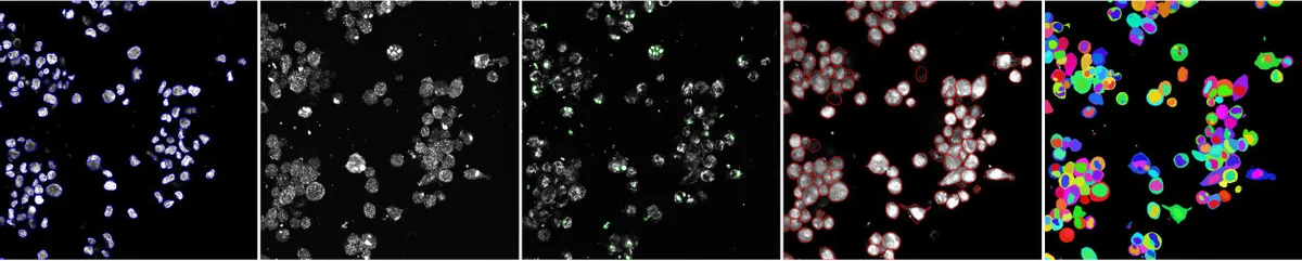 One field shown as separate channels followed by the cell, nucleus and parasite masks