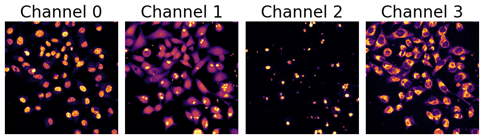 channels